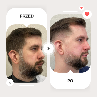 przed-po